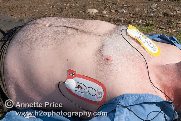 First aid outdoors - using a defibrillator