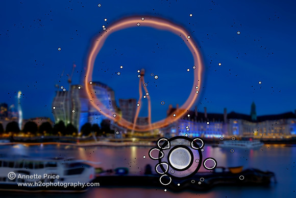 Eight days after the operation - damaged eye only (good eye closed).  London Eye.
